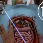 Vidéo choc: Il échappe un laser chirurgical sur son patient!